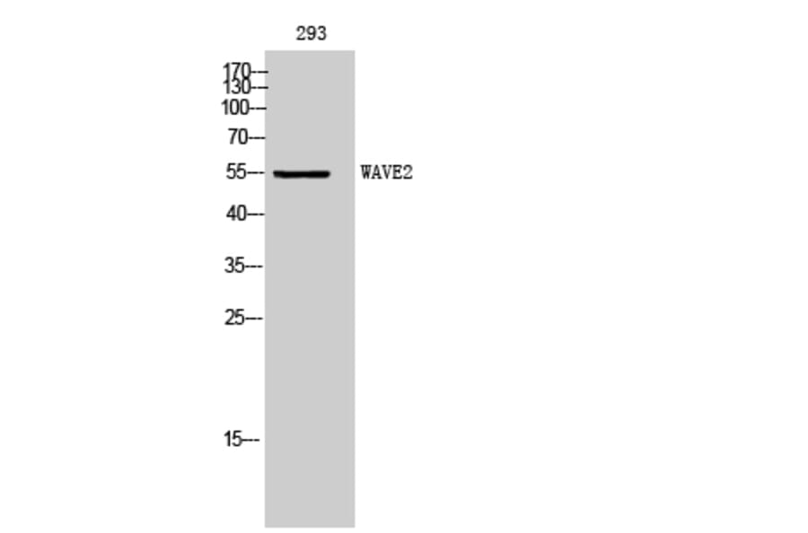 Western Blot - Anti-WASF2 Antibody (C19560) - Antibodies.com