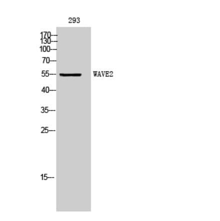 Western Blot - Anti-WASF2 Antibody (C19560) - Antibodies.com