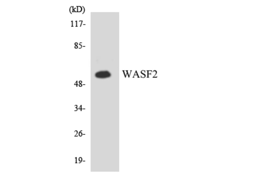 Western Blot - Anti-WASF2 Antibody (R12-3680) - Antibodies.com