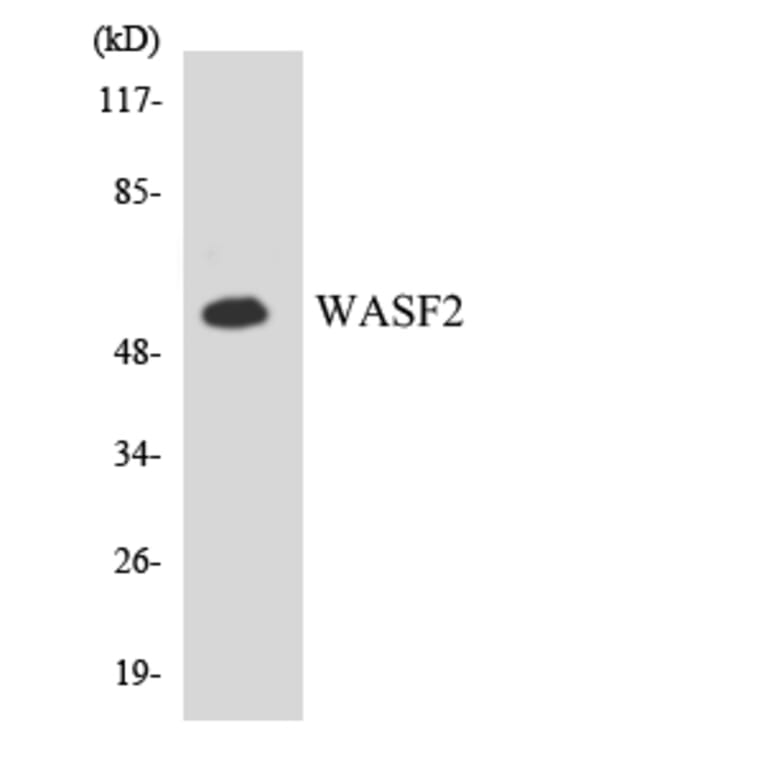 Western Blot - Anti-WASF2 Antibody (R12-3680) - Antibodies.com
