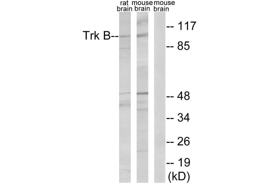 Western Blot - Anti-Trk B Antibody (B0035) - Antibodies.com