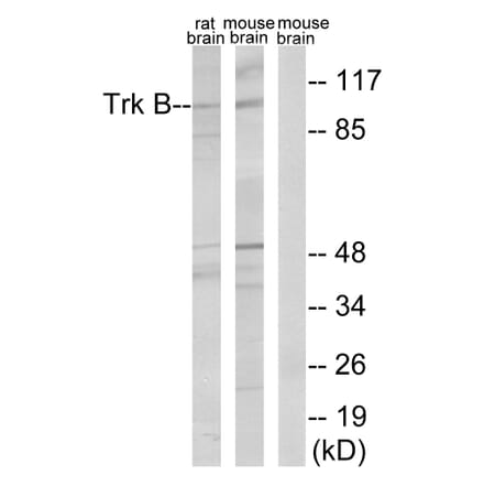 Western Blot - Anti-Trk B Antibody (B0035) - Antibodies.com