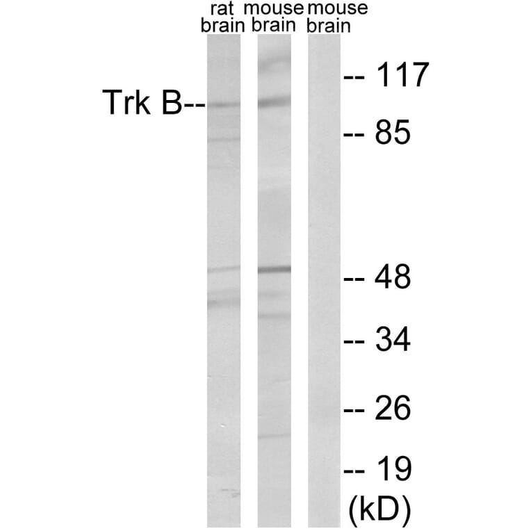 Western Blot - Anti-Trk B Antibody (B0035) - Antibodies.com