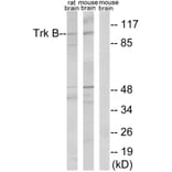 Western Blot - Anti-Trk B Antibody (B0035) - Antibodies.com
