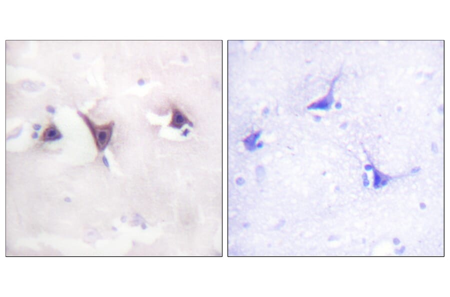Immunohistochemistry - Anti-Trk B Antibody (B0035) - Antibodies.com