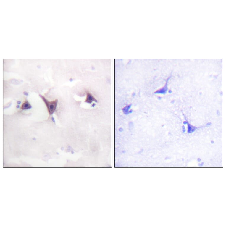 Immunohistochemistry - Anti-Trk B Antibody (B0035) - Antibodies.com
