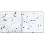 Immunohistochemistry - Anti-Trk B Antibody (B0035) - Antibodies.com