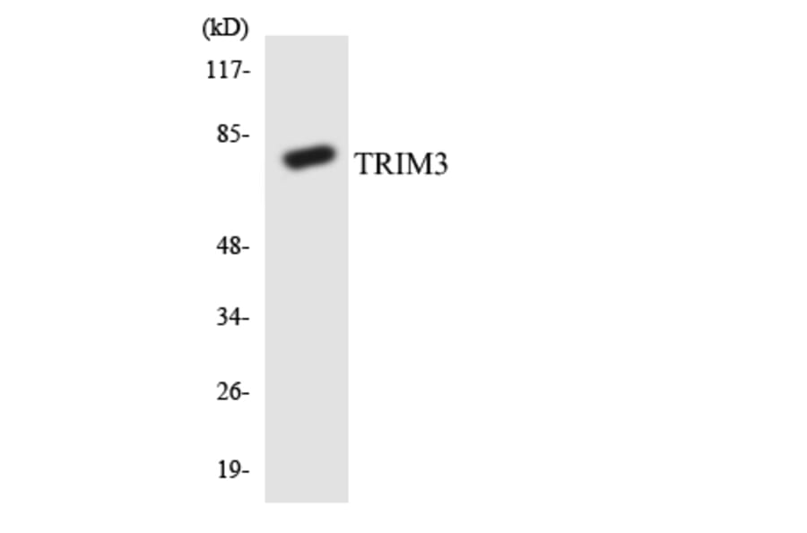 Western Blot - Anti-TRIM3 Antibody (R12-3651) - Antibodies.com