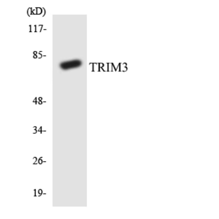 Western Blot - Anti-TRIM3 Antibody (R12-3651) - Antibodies.com