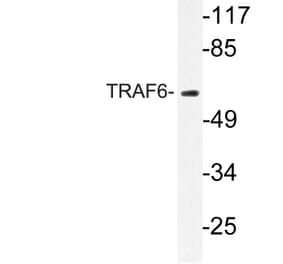 Western Blot - Anti-TRAF6 Antibody (R12-2386) - Antibodies.com