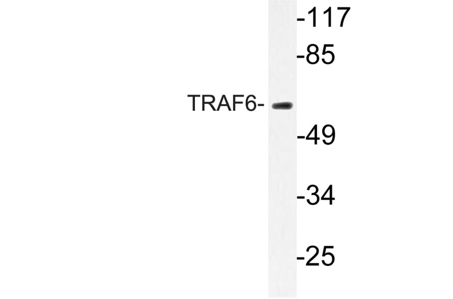 Western Blot - Anti-TRAF6 Antibody (R12-2386) - Antibodies.com