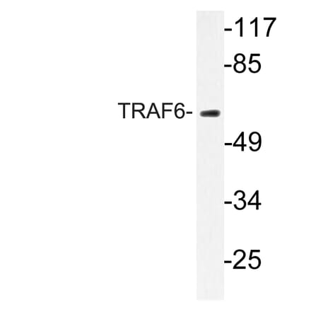 Western Blot - Anti-TRAF6 Antibody (R12-2386) - Antibodies.com