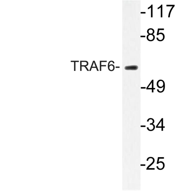 Western Blot - Anti-TRAF6 Antibody (R12-2386) - Antibodies.com