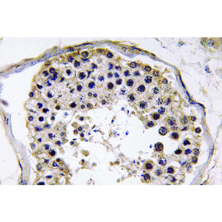 Immunohistochemistry - Anti-TRAF6 Antibody (R12-2386) - Antibodies.com