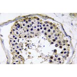 Immunohistochemistry - Anti-TRAF6 Antibody (R12-2386) - Antibodies.com