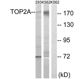 Western Blot - Anti-TOP2A Antibody (B8439) - Antibodies.com