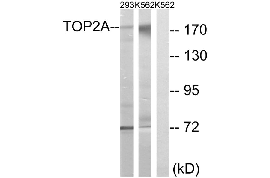 Western Blot - Anti-TOP2A Antibody (B8439) - Antibodies.com