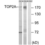 Western Blot - Anti-TOP2A Antibody (B8439) - Antibodies.com
