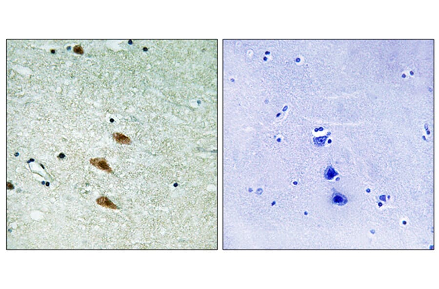 Immunohistochemistry - Anti-TOP2A Antibody (B8439) - Antibodies.com