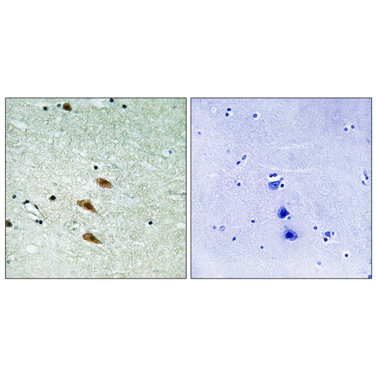 Immunohistochemistry - Anti-TOP2A Antibody (B8439) - Antibodies.com