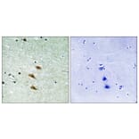 Immunohistochemistry - Anti-TOP2A Antibody (B8439) - Antibodies.com
