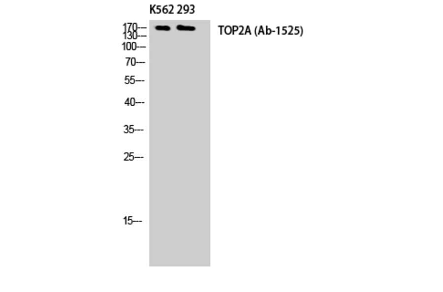 Western Blot - Anti-TOP2A Antibody (B8439) - Antibodies.com