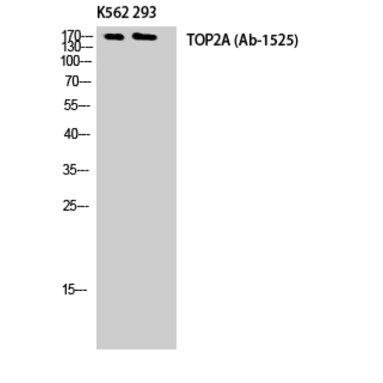 Western Blot - Anti-TOP2A Antibody (B8439) - Antibodies.com