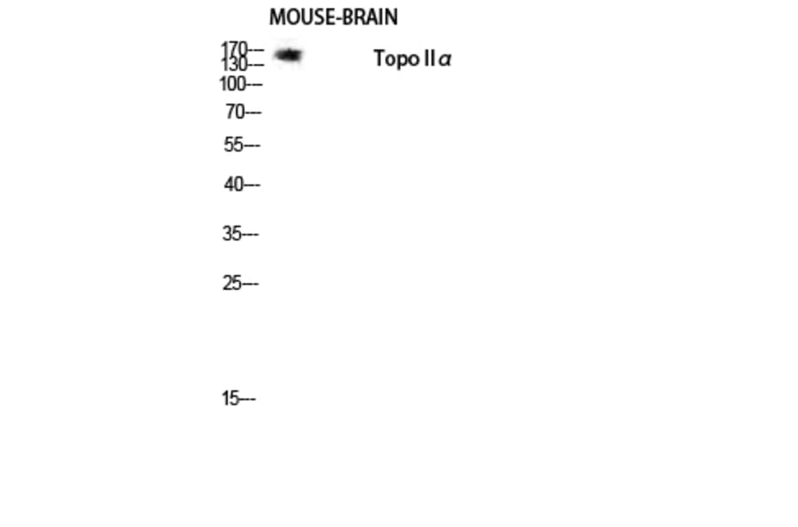 Western Blot - Anti-TOP2A Antibody (B8439) - Antibodies.com