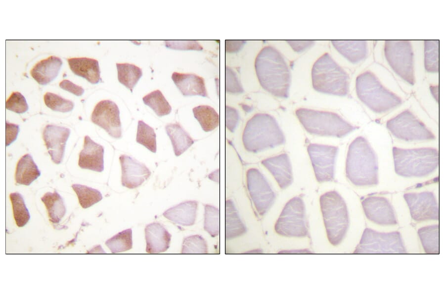 Immunohistochemistry - Anti-TNNI3 Antibody (B0588) - Antibodies.com