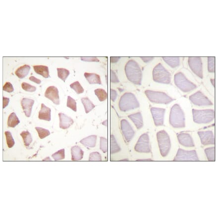 Immunohistochemistry - Anti-TNNI3 Antibody (B0588) - Antibodies.com