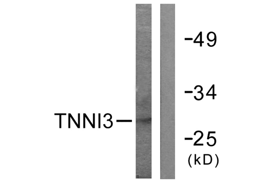 Western Blot - Anti-TNNI3 Antibody (B0588) - Antibodies.com