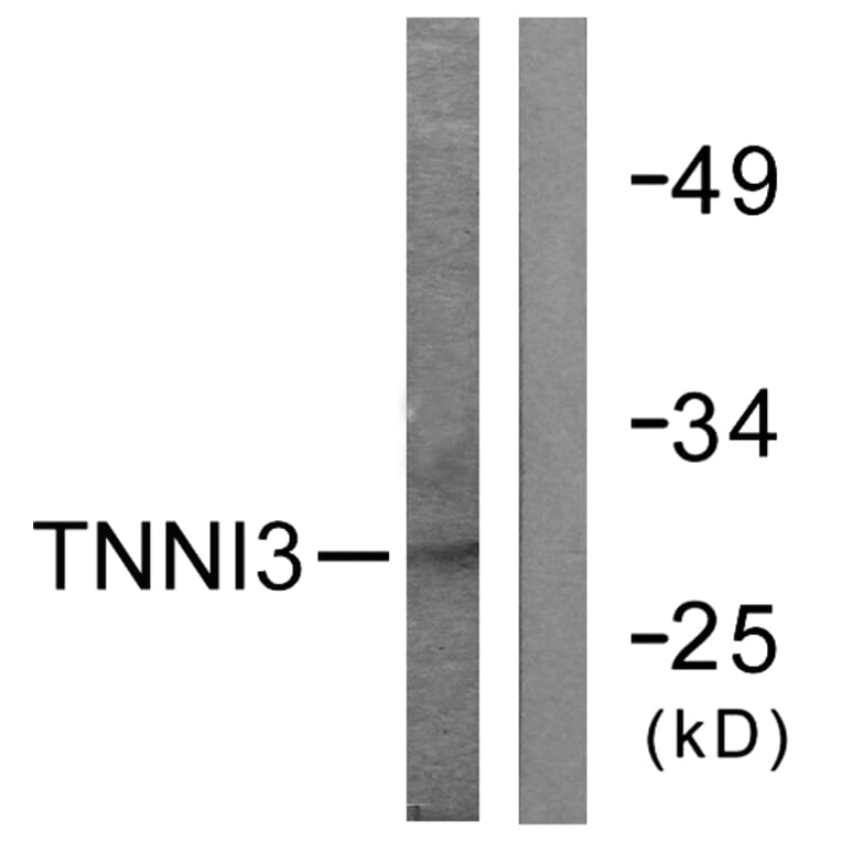 Western Blot - Anti-TNNI3 Antibody (B0588) - Antibodies.com