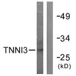 Western Blot - Anti-TNNI3 Antibody (B0588) - Antibodies.com