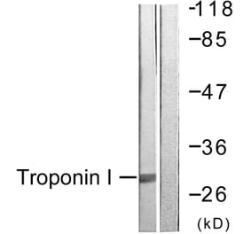 Western Blot - Anti-TNNI3 Antibody (B0816) - Antibodies.com