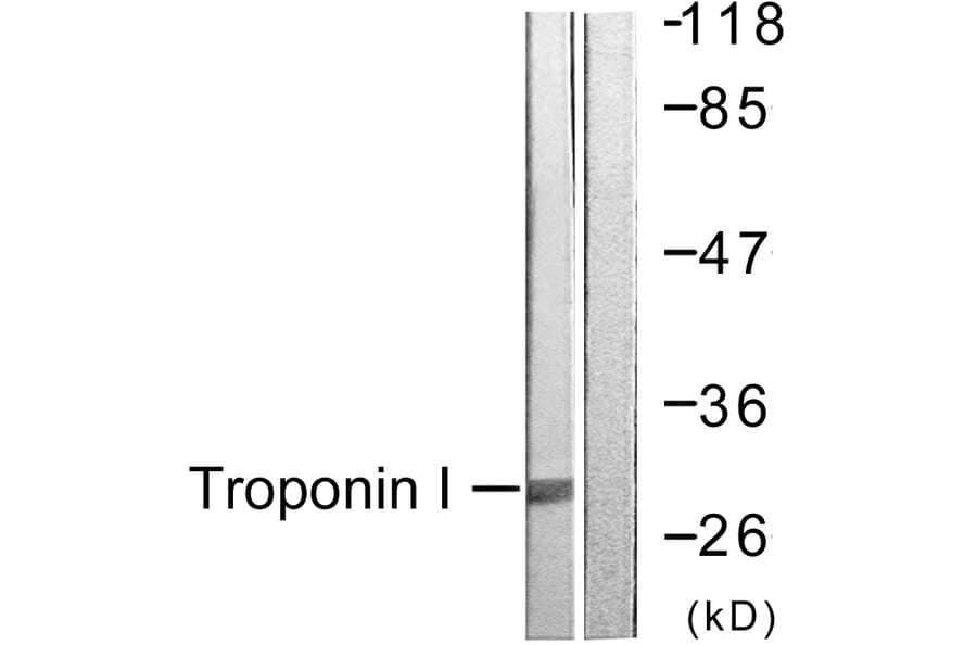 Western Blot - Anti-TNNI3 Antibody (B0816) - Antibodies.com