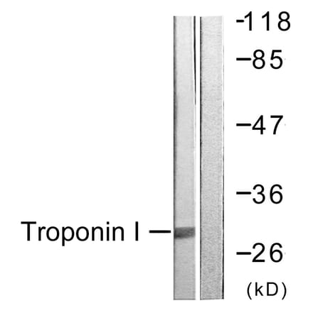 Western Blot - Anti-TNNI3 Antibody (B0816) - Antibodies.com