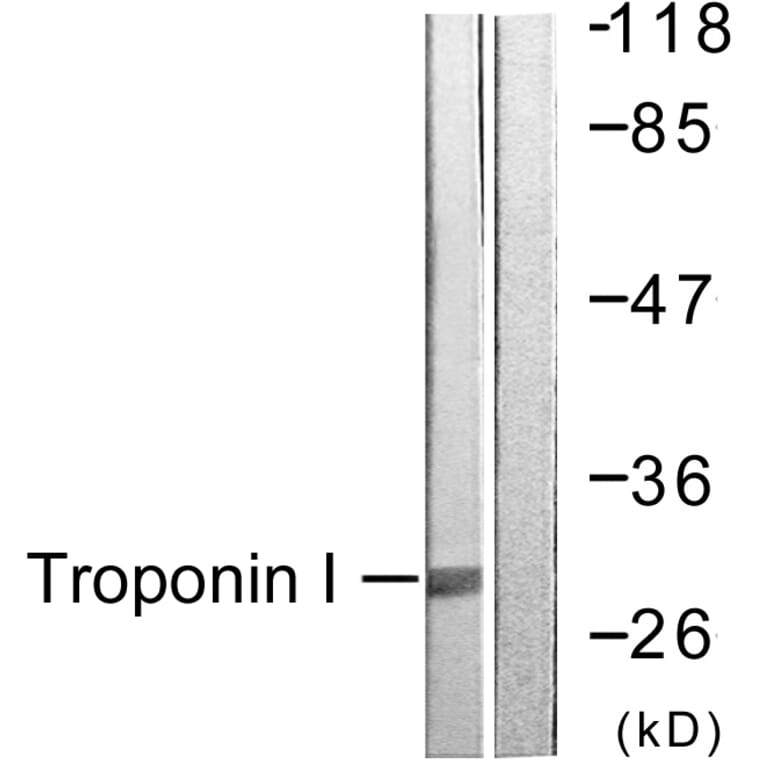 Western Blot - Anti-TNNI3 Antibody (B0816) - Antibodies.com