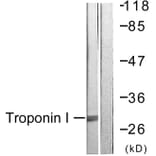 Western Blot - Anti-TNNI3 Antibody (B0816) - Antibodies.com
