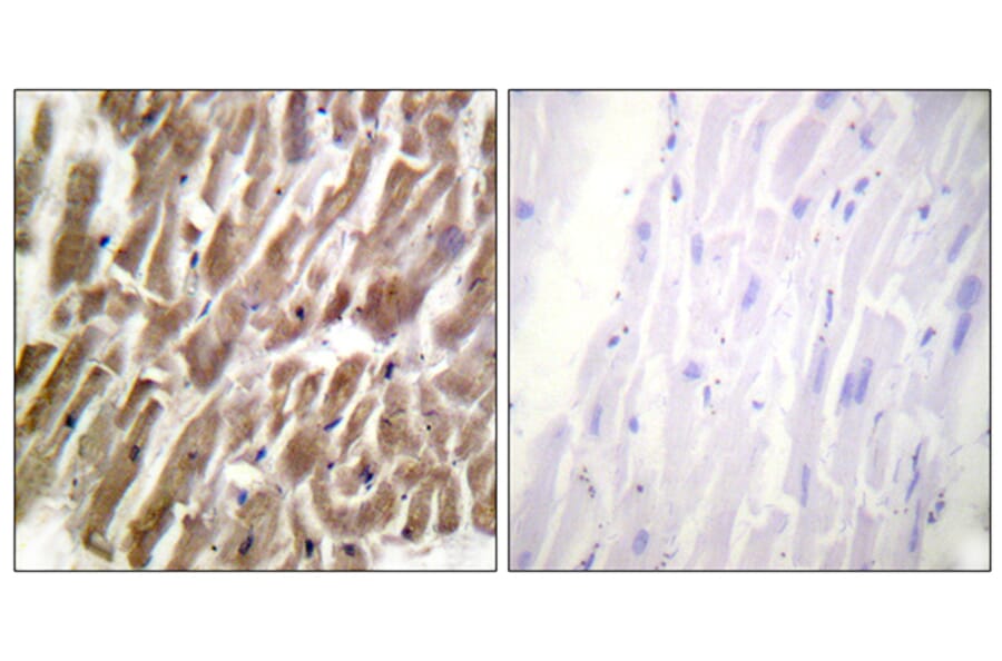 Immunohistochemistry - Anti-TNNI3 Antibody (B0816) - Antibodies.com