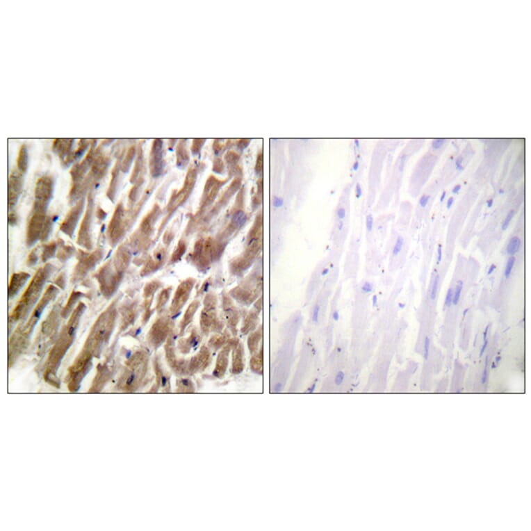 Immunohistochemistry - Anti-TNNI3 Antibody (B0816) - Antibodies.com