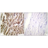 Immunohistochemistry - Anti-TNNI3 Antibody (B0816) - Antibodies.com
