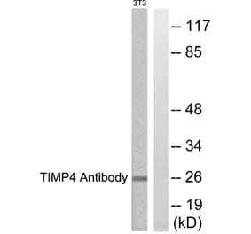Western Blot - Anti-TIMP4 Antibody (C0374) - Antibodies.com