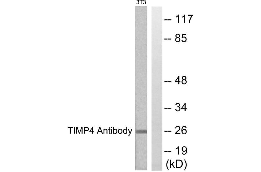 Western Blot - Anti-TIMP4 Antibody (C0374) - Antibodies.com