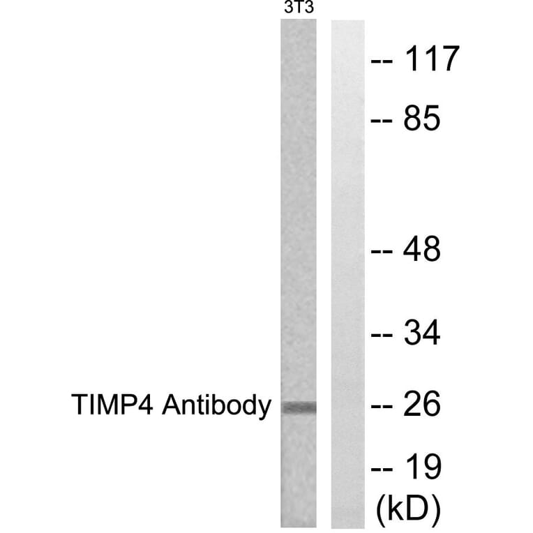 Western Blot - Anti-TIMP4 Antibody (C0374) - Antibodies.com