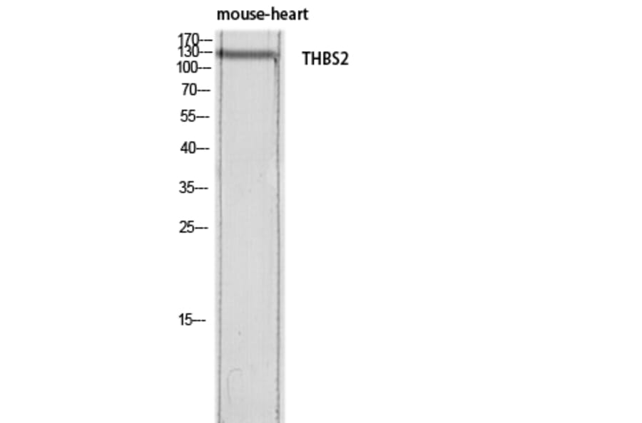 Western Blot - Anti-THBS2 Antibody (C30156) - Antibodies.com