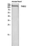 Western Blot - Anti-THBS2 Antibody (C30156) - Antibodies.com