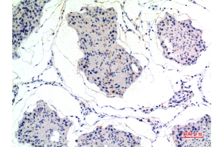 Immunohistochemistry - Anti-THBS2 Antibody (C30156) - Antibodies.com
