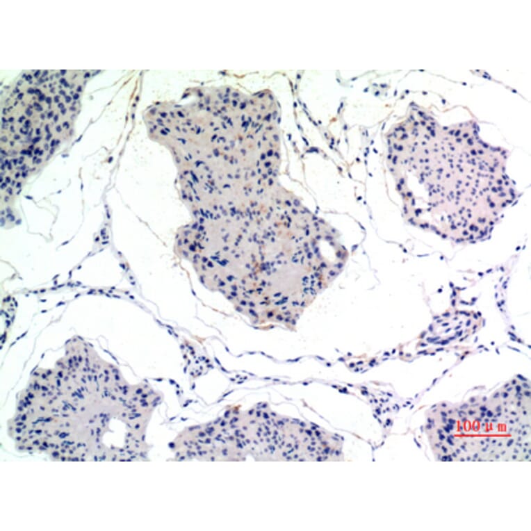 Immunohistochemistry - Anti-THBS2 Antibody (C30156) - Antibodies.com