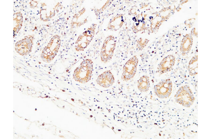 Immunohistochemistry - Anti-THBS2 Antibody (C30156) - Antibodies.com