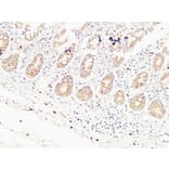 Immunohistochemistry - Anti-THBS2 Antibody (C30156) - Antibodies.com